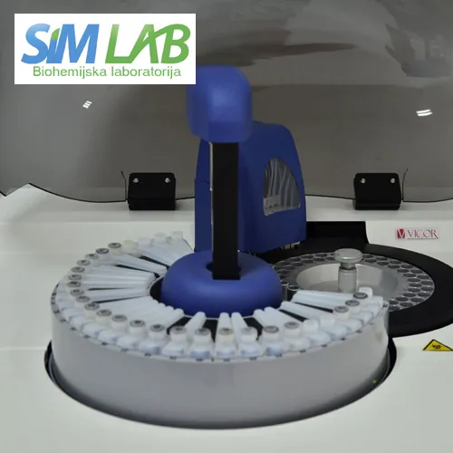 Mioglobin SIM LAB - Laboratorija za medicinsku biohemiju SIM LAB - 1