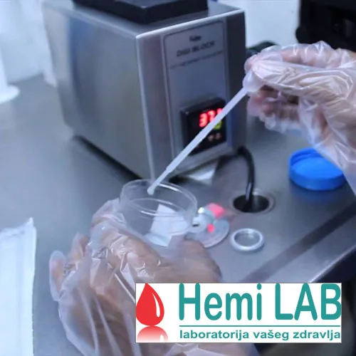 Spermogram HEMI LAB - Hemi Lab Laboratorija - 2
