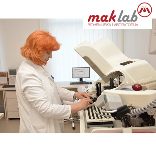 Tumor markeri LABORATORIJA MAK LAB - Laboratorija Mak Lab - 2