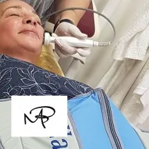 Radiotalasni lifting lica  ESTETSKI CENTAR DR MARIJA BOŠKOVIĆ - Medical Beauty - Estetski centar dr Marija Bošković - 1