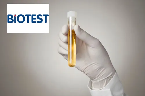 Analiza urina BIOTEST - Biohemijska laboratorija Biotest - 2