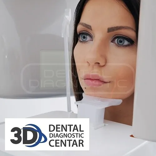 2D SNIMAK TMZ - Dental Diagnostic Centar - 2