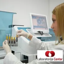 Droge u urinu LABORATORIJA CENTAR - Laboratorija Centar - 2