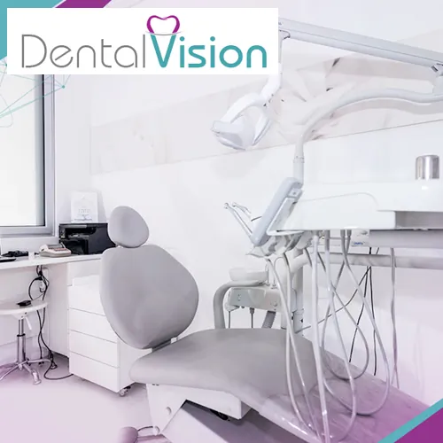 Beljenje zuba DENTAL VISION - Stomatološka ordinacija Dental Vision - 1