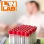 Hematologija LIN LAB - Laboratorija Lin Lab - 1