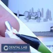 Metalokeramičke krunice DENTAL LAB - Dental Lab - 1