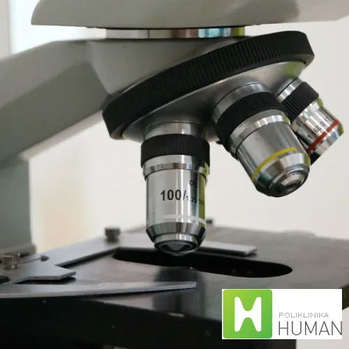 Spermogram HUMAN LABORATORIJE - Human laboratorije - 2