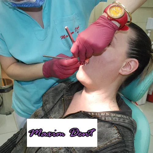 Vađenje mlečnog zuba MAXIM DENT - Stomatološka ordinacija Maxim Dent - 3