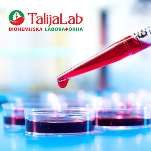 Netolerancija na hranu-screen TALIJA LAB - Biohemijska laboratorija Talija Lab - 4