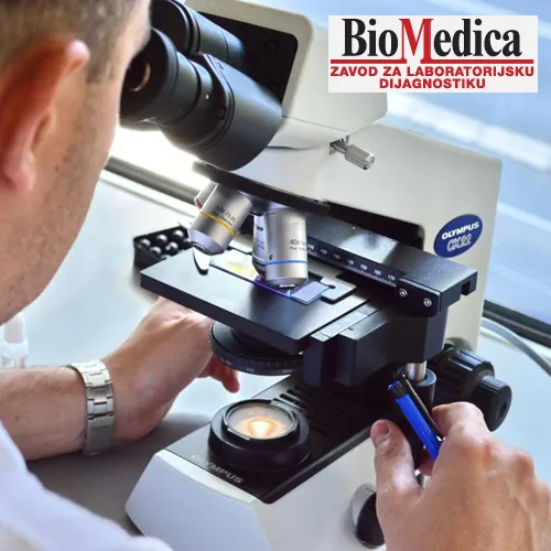 Intolerancija na hranu BIOMEDICA - Biohemijske laboratorije BIOMEDICA - 2