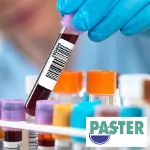 Tumor markeri LABORATORIJA PASTER - Laboratorija Paster - 1
