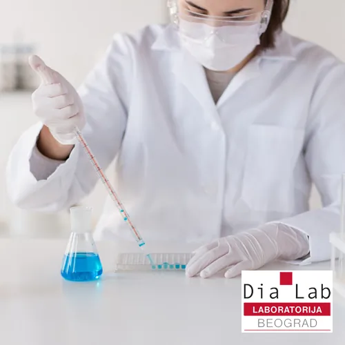 Alergeni DIA LAB - DIA LAB laboratorija - 2