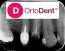 Dentalni radiogrami ORTO DENT DIGITAL 3D - ORTOPAN CENTAR - Orto Dent Digital 3D - Ortopan centar - 2