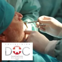 Alpha Bio Implantat i Abatment DENTAL ORAL CENTAR MILOŠEVIĆ - Stomatološka ordinacija dental Oral Centar Milošević - 1