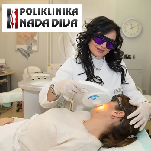 Epilacija celog lica POLIKLINIKA NADA DIVA - Poliklinika Nada Diva - 4
