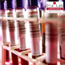 Hormoni štitne žlezde DIA LAB - DIA LAB laboratorija - 1