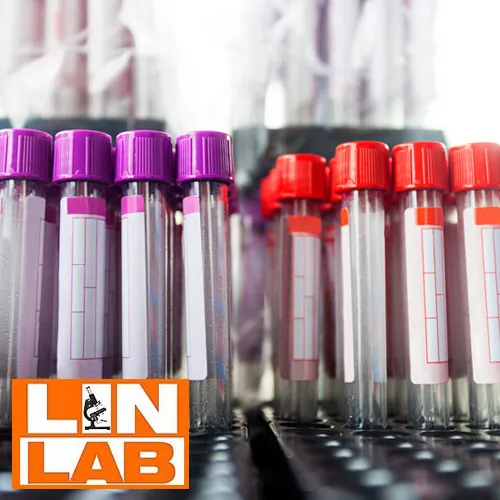 Tumor markeri LIN LAB - Laboratorija Lin Lab - 1
