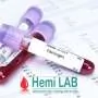 Fibrinogen HEMI LAB - Hemi Lab Laboratorija - 1