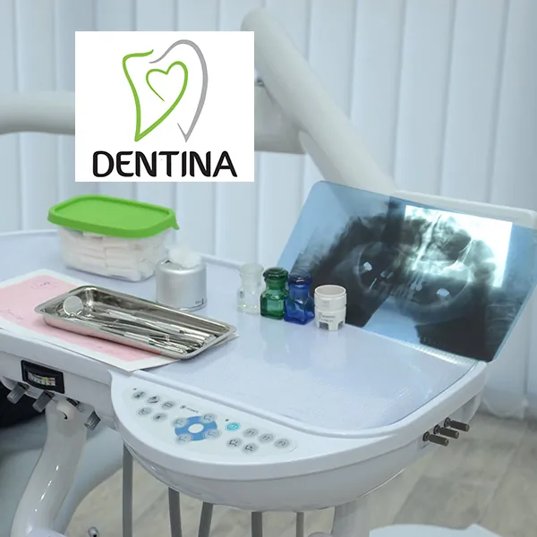 Implantat DENTINA - Stomatološka ordinacija Dentina - 1