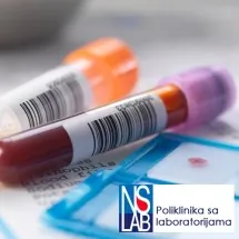 Hematologija NS LAB - Laboratorije NS LAB - 1