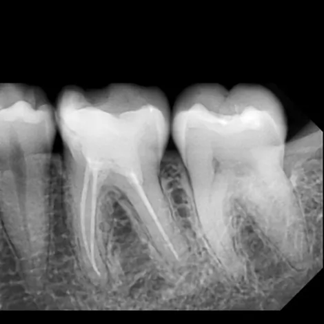 RA SNIMAK - Dental Diagnostic Centar - 3
