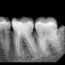 RA SNIMAK - Dental Diagnostic Centar - 3