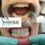 Beljenje zuba MRSE DENT - Stomatološka ordinacija Mrse Dent - 3