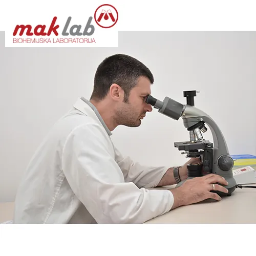 Alergijski paneli MAK LAB LABORATORIJA - Laboratorija Mak Lab - 1