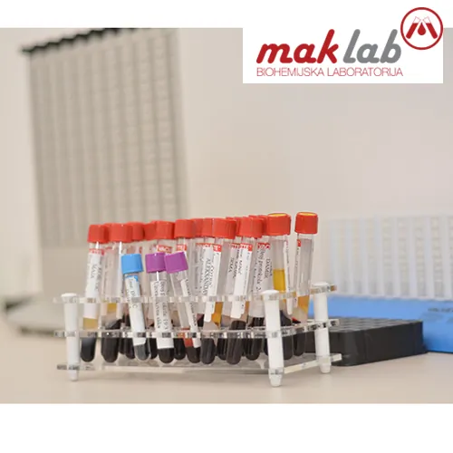 Krvna slika LABORATORIJA MAK LAB - Laboratorija Mak Lab - 3