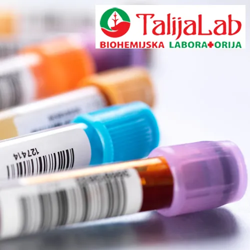 Tumor markeri TALIJA LAB - Biohemijska laboratorija Talija Lab - 4