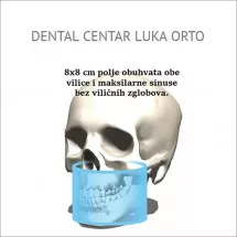 3D SNIMAK L polje 8×8 cm - Dental centar Luka Orto - 1