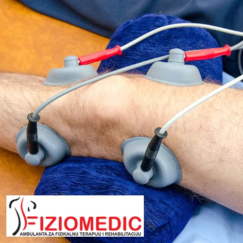 Elektroterapija - Mag.,Dds, Tens, Es FIZIOMEDIC - Fiziomedic Ambulanta za fizikalnu terapiju i rehabilitaciju - 2