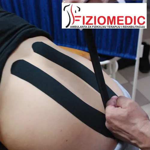 Kinesio Taping FIZIOMEDIC - Fiziomedic Ambulanta za fizikalnu terapiju i rehabilitaciju - 2