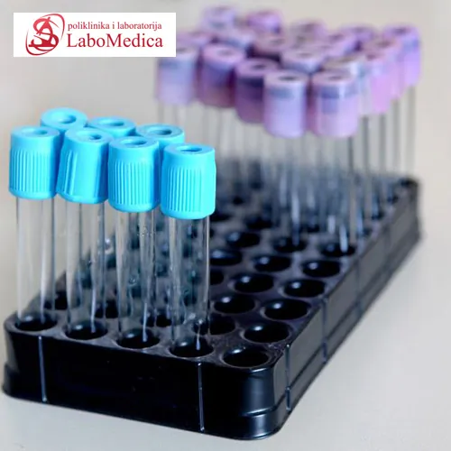 Albumini LABOMEDICA - Poliklinika i laboratorija LABOMEDICA - 2