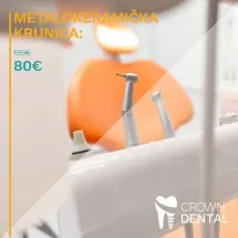 Metalokeramička krunica CROWN DENTAL - Stomatološka ordinacija Crown Dental - 1