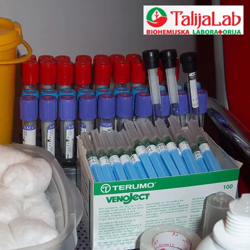 Krvna grupa i Rh faktor TALIJA LAB - Biohemijska laboratorija Talija Lab - 1