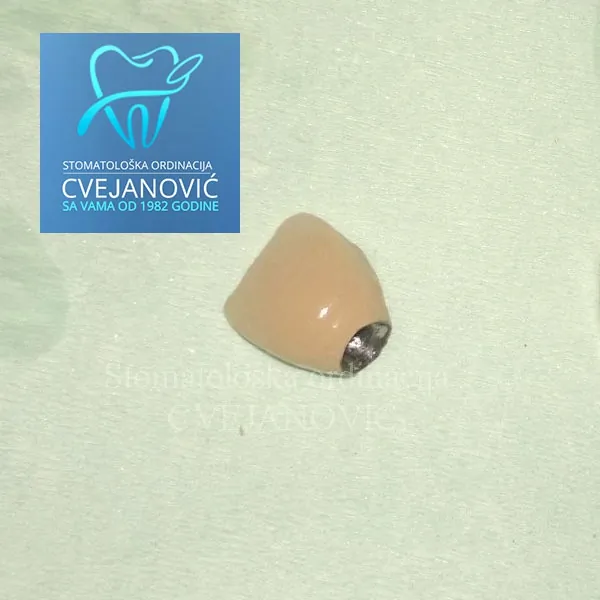 Ugradnja zubnih implantata Impant Direct ORDINACIJA CVEJANOVIĆ - Stomatološka ordinacija Cvejanović - 2