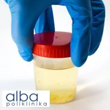 Urin POLIKLINIKA ALBA - Poliklinika Alba - 1