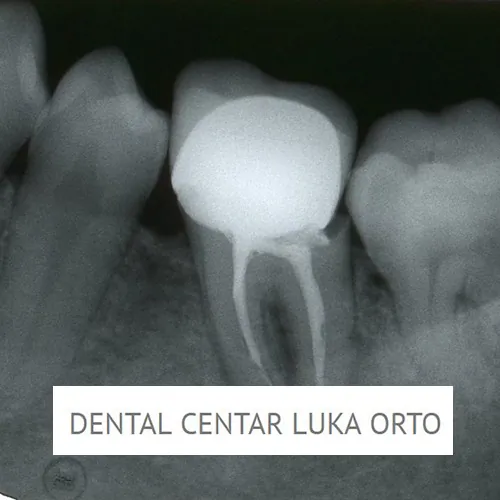 Dentalni snimak DENTAL CENTAR LUKA ORTO - Dental centar Luka Orto - 2