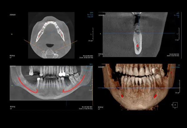 3D CBCT  Srednje radno polje  M 8x8 - Centar za snimanje zuba Diamond 3D - 3