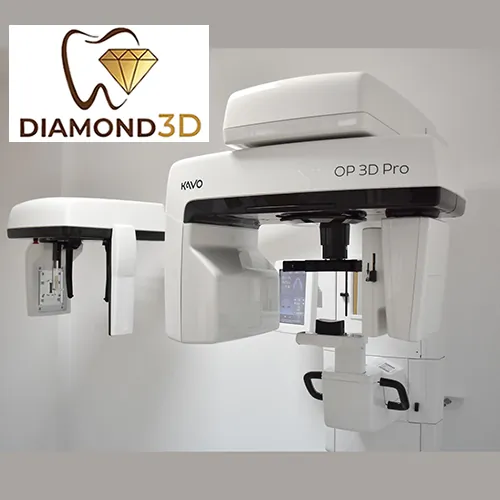 3D CBCT  Srednje radno polje  M 8x8 - Centar za snimanje zuba Diamond 3D - 1