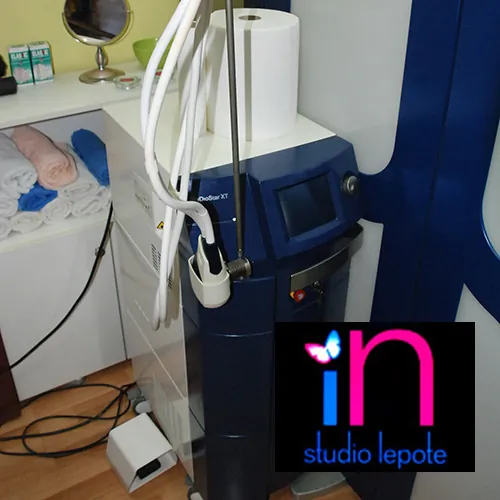 Epilacija laserom STUDIO LEPOTE IN - Studio lepote In - 1