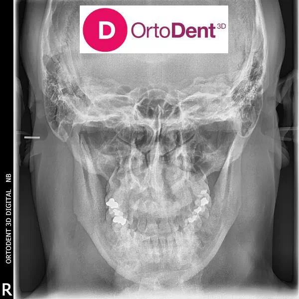 RTG Sinusa ORTO DENT DIGITAL 3D - ORTOPAN CENTAR - Orto Dent Digital 3D - Ortopan centar - 2