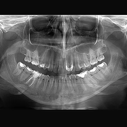 ORTOPAN SNIMAK - Dental Diagnostic Centar - 1