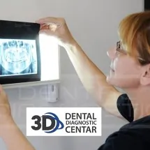 ORTOPAN SNIMAK - Dental Diagnostic Centar - 2