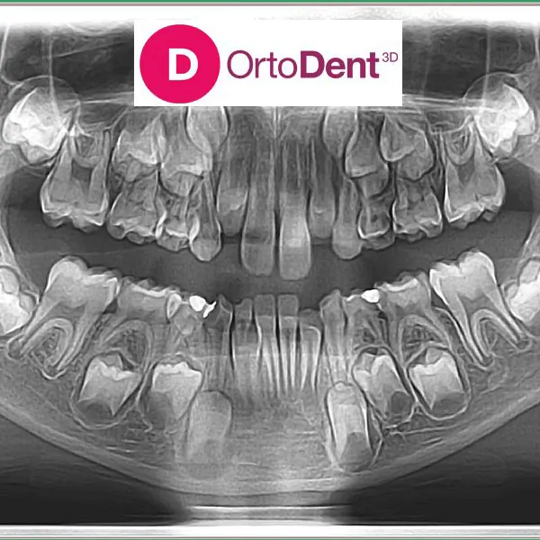 Ortopan ORTO DENT DIGITAL 3D - ORTOPAN CENTAR - Orto Dent Digital 3D - Ortopan centar - 2