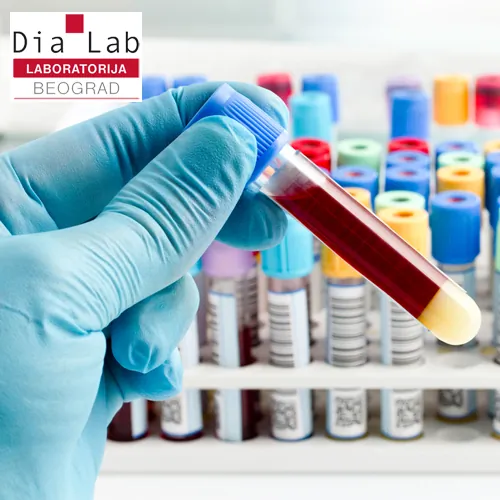 Hematologija DIA LAB - DIA LAB laboratorija - 2