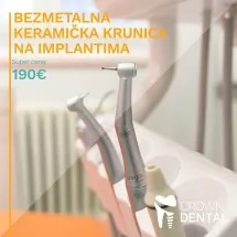 Bezmetalna keramička krunica na implantatima CROWN DENTAL - Stomatološka ordinacija Crown Dental - 1