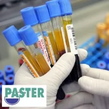 Tast na drogu Urin LABORATORIJA PASTER - Laboratorija Paster - 1