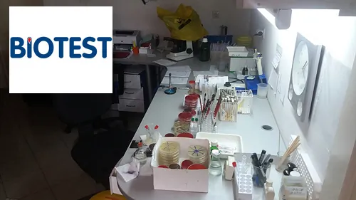 Double test BIOTEST - Biohemijska laboratorija Biotest - 2
